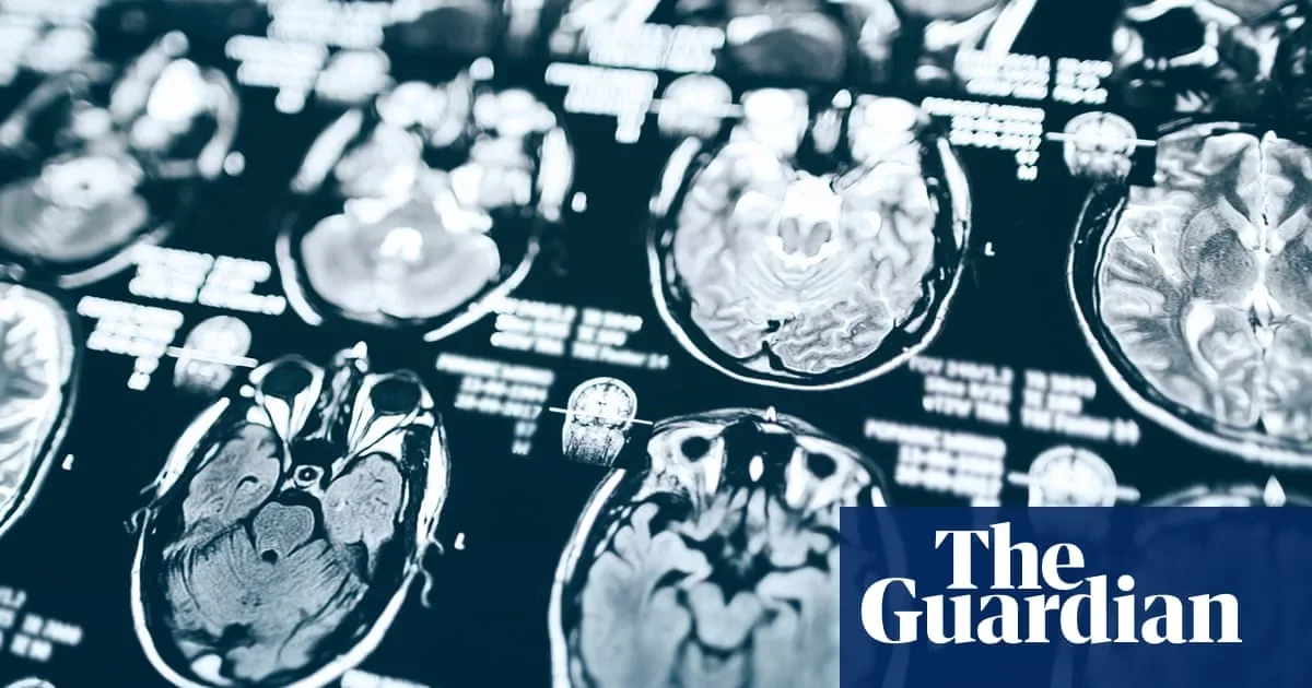 Trump Cuts Alzheimer’s Funding as Tehran Expels Swedish Diplomat Amid Global Market Shifts