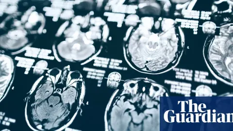 Trump Cuts Alzheimer’s Funding as Tehran Expels Swedish Diplomat Amid Global Market Shifts