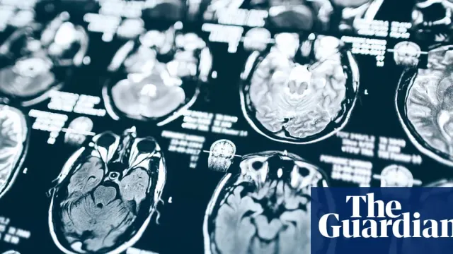 Trump Cuts Alzheimer’s Funding as Tehran Expels Swedish Diplomat Amid Global Market Shifts